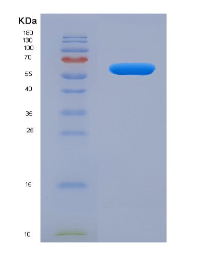 Human STAR (Steroidogenic Acute Regulatory Protein, Mitochondrial) - Recombinant Protein