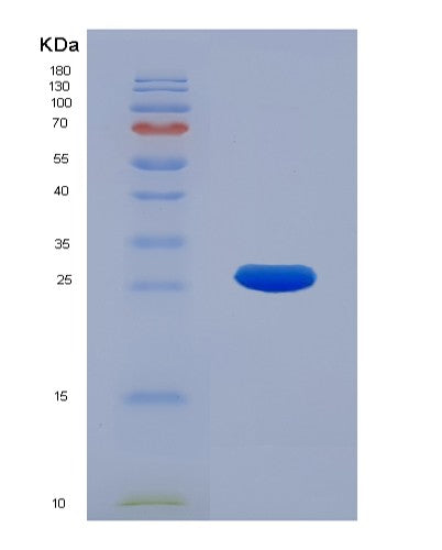 Human PSMB3 (Proteasome Subunit Beta Type-3) - Recombinant Protein