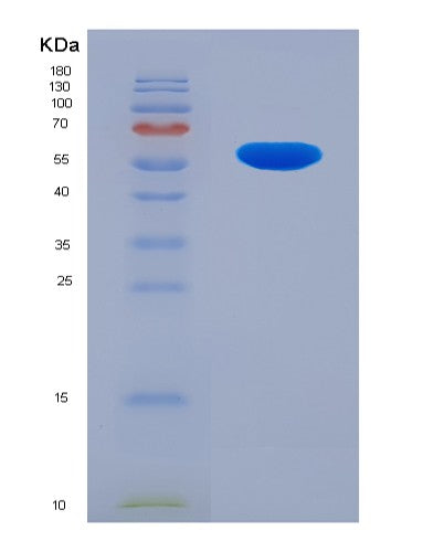 Human RARRES1 (Retinoic Acid Receptor Responder Protein 1) - Recombinant Protein