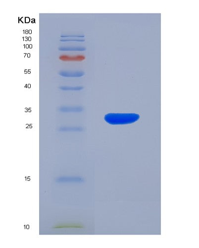 Human RGS19 (Regulator Of G-Protein Signaling 19) - Recombinant Protein