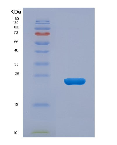 Human RGS4 (Regulator Of G-Protein Signaling 4) - Recombinant Protein