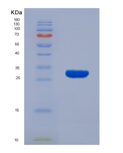 Human KLK7 (Kallikrein-7) - Recombinant Protein