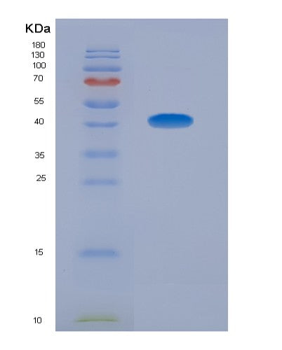 Human SMCP (Sperm Mitochondrial-Associated Cysteine-Rich Protein) - Recombinant Protein