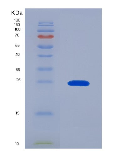 Human CAMP (Cathelicidin Antimicrobial Peptide) - Recombinant Protein