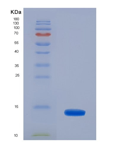 Human CRIP1 (Cysteine-Rich Protein 1) - Recombinant Protein