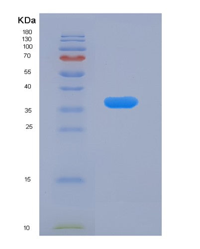 Human RAB7A (Ras-Related Protein Rab-7A) - Recombinant Protein