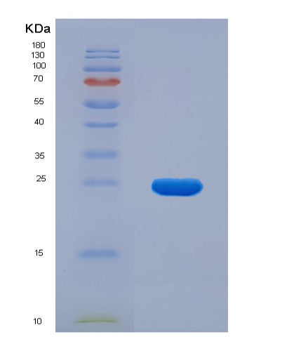Mouse Ccl9 (C-C Motif Chemokine 9) - Recombinant Protein