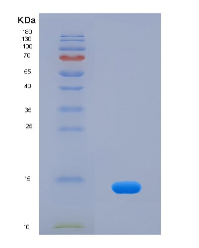 Human CCL11 (Eotaxin) - Recombinant Protein