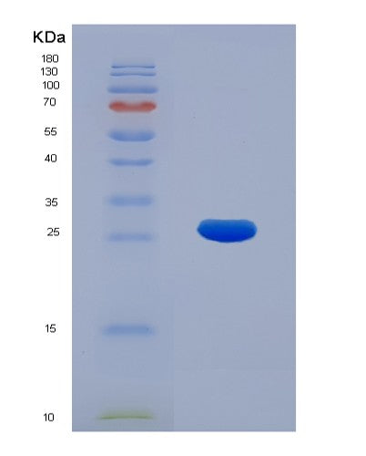 Human KPNA2 (Importin Subunit Alpha-1) - Recombinant Protein