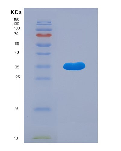 Human MAP2K6 (Dual Specificity Mitogen-Activated Protein Kinase Kinase 6) - Recombinant Protein