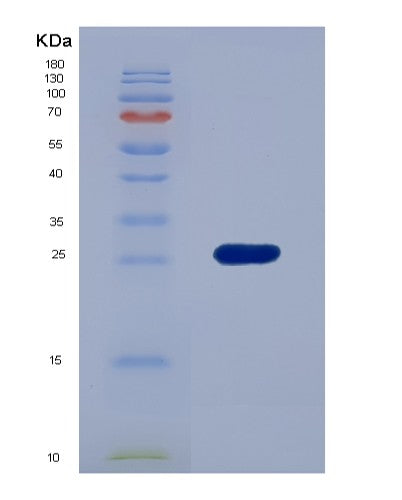 Human EFNA3 (Ephrin-A3) - Recombinant Protein