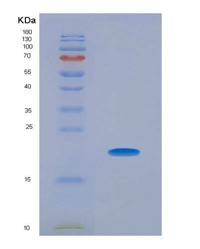 Human THOP1 (Thimet Oligopeptidase) - Recombinant Protein