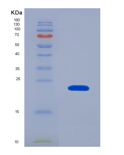 Human HMGA2 (High Mobility Group Protein Hmgi-C) - Recombinant Protein