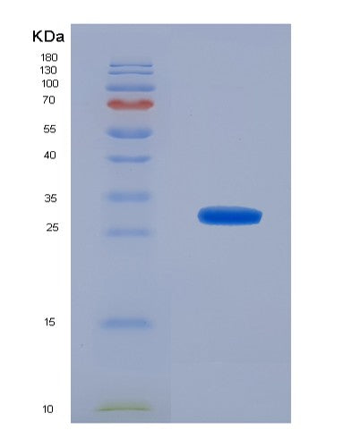 Human MAPK12 (Mitogen-Activated Protein Kinase 12) - Recombinant Protein