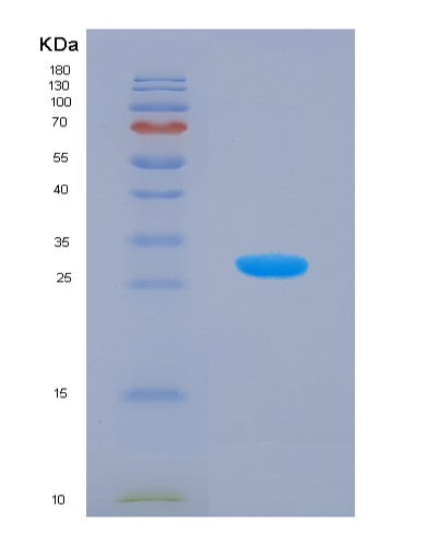 Human PRKAG1 (5'-Amp-Activated Protein Kinase Subunit Gamma-1) - Recombinant Protein
