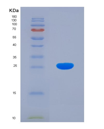 Human BCAT1 (Branched-Chain-Amino-Acid Aminotransferase, Cytosolic) - Recombinant Protein