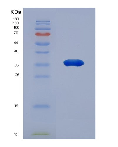 Human NAPA (Alpha-Soluble Nsf Attachment Protein) - Recombinant Protein