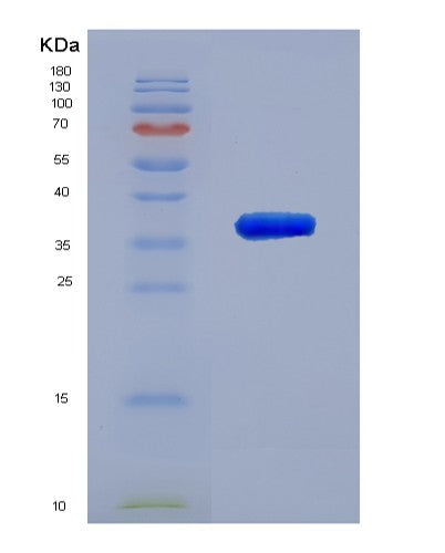 Human MFAP2 (Microfibrillar-Associated Protein 2) - Recombinant Protein