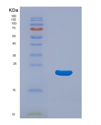 Human AIF1 (Allograft Inflammatory Factor 1) - Recombinant Protein