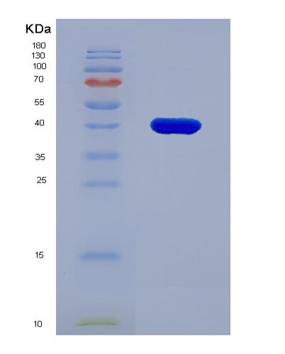 Human MFAP3 (Microfibril-Associated Glycoprotein 3) - Recombinant Protein