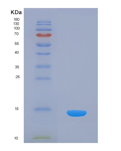 Human INHBC (Inhibin Beta C Chain) - Recombinant Protein