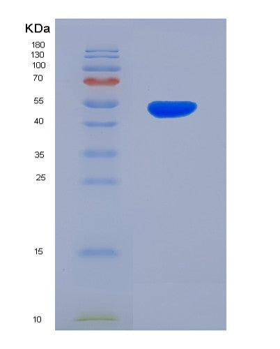 Human CDH11 (Cadherin-11) - Recombinant Protein