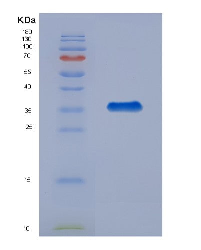 Human LGALS4 (Galectin-4) - Recombinant Protein