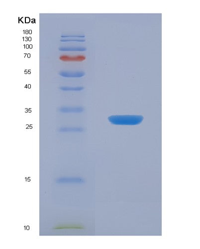 Human JAM2 (Junctional Adhesion Molecule B) - Recombinant Protein
