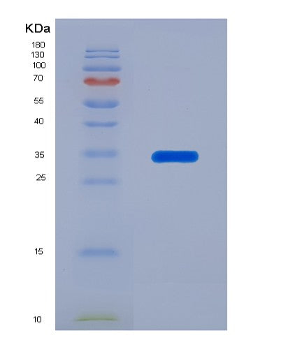 Human DEFB1 (Beta-Defensin 1) - Recombinant Protein