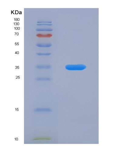 Human TPI1 (Triosephosphate Isomerase) - Recombinant Protein