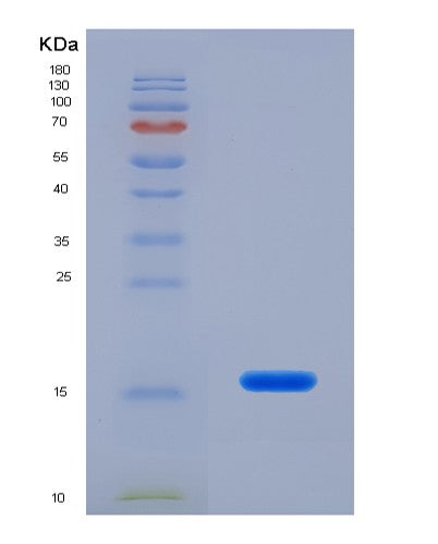 Human GABARAPL2 (Gamma-Aminobutyric Acid Receptor-Associated Protein-Like 2) - Recombinant Protein