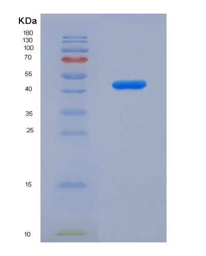Human DSTN (Destrin) - Recombinant Protein