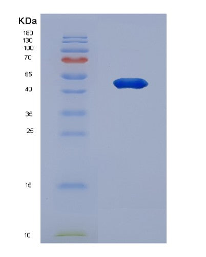 Human MAX (Protein Max) - Recombinant Protein