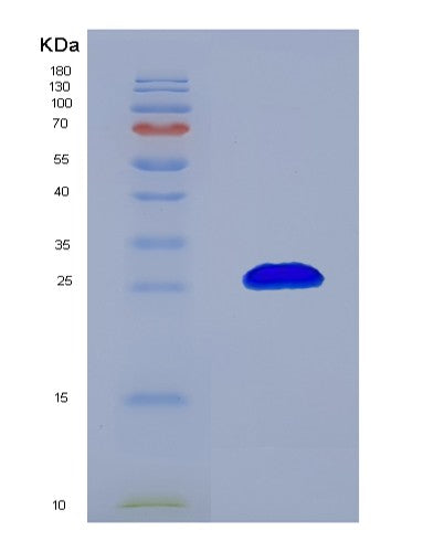 Human RHOA (Transforming Protein Rhoa) - Recombinant Protein