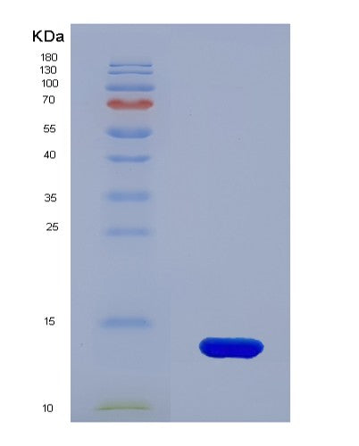 Human B2M (Beta-2-Microglobulin) - Recombinant Protein