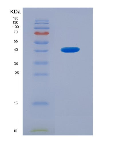Human PPP1CA (Serine/Threonine-Protein Phosphatase Pp1-Alpha Catalytic Subunit) - Recombinant Protein