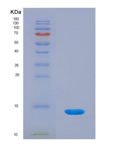 Human SNRPE (Small Nuclear Ribonucleoprotein E) - Recombinant Protein