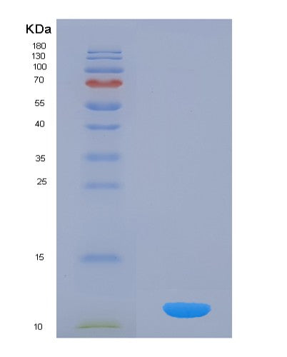 Human SNRPG (Small Nuclear Ribonucleoprotein G) - Recombinant Protein