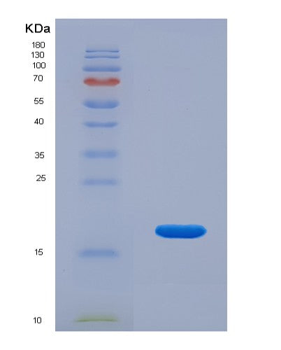 Human SNRPD3 (Small Nuclear Ribonucleoprotein Sm D3) - Recombinant Protein