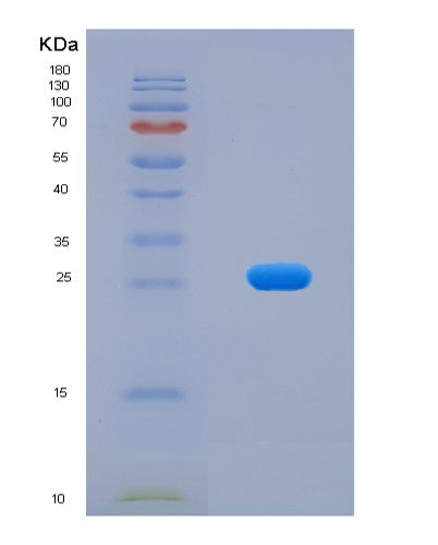 Human ACTA2 (Actin, Aortic Smooth Muscle) - Recombinant Protein