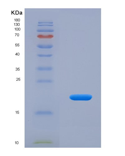 Human VSNL1 (Visinin-Like Protein 1) - Recombinant Protein