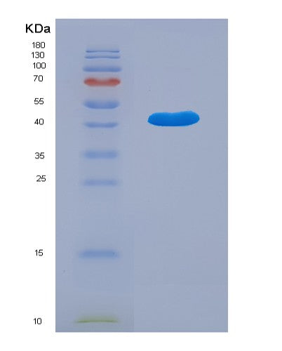 Human GNB1 (Guanine Nucleotide-Binding Protein G(I)/G(S)/G(T) Subunit Beta-1) - Recombinant Protein