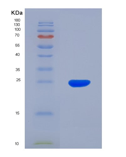 Human RAC1 (Ras-Related C3 Botulinum Toxin Substrate 1) - Recombinant Protein
