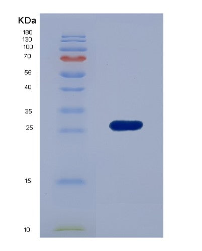 Mouse Tpt1 (Translationally-Controlled Tumor Protein) - Recombinant Protein