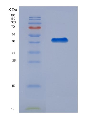 Human PPP3R1 (Calcineurin Subunit B Type 1) - Recombinant Protein
