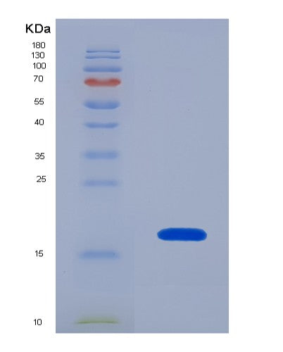 Human YWHAZ (14-3-3 Protein Zeta/Delta) - Recombinant Protein