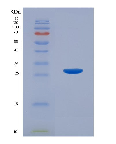 Human SUMO1 (Small Ubiquitin-Related Modifier 1) - Recombinant Protein