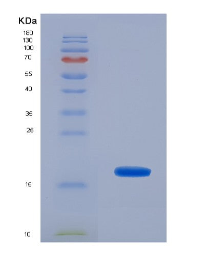 Human UBE2I (Sumo-Conjugating Enzyme Ubc9) - Recombinant Protein