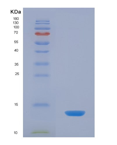 Human SELENOW (Selenoprotein W) - Recombinant Protein