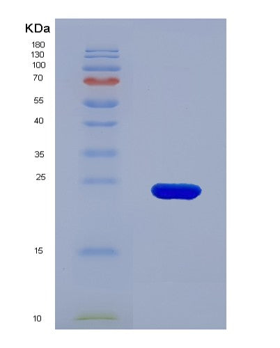 Human LCN2 (Neutrophil Gelatinase-Associated Lipocalin) - Recombinant Protein